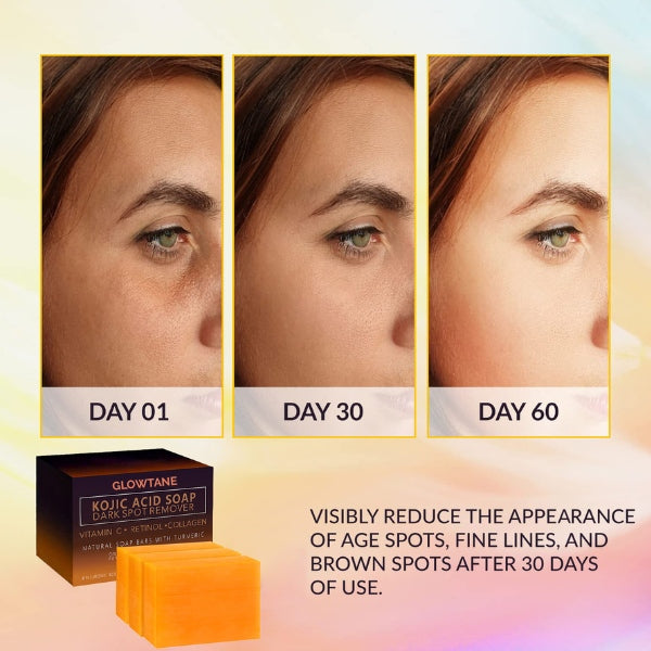 Kojic Acid & Turmeric Dark Spot Corrector Soap