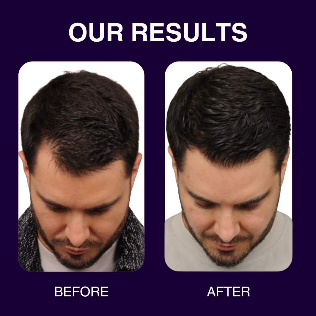 Glowtane Hair Loss & Growth Serum